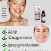 Siero viso attivi puri acido azelaico da 30ml.